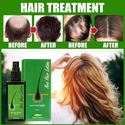 Neo Hair Lotion Serum – 120ml