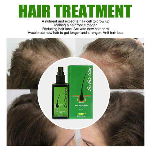 Neo Hair Lotion Serum – 120ml