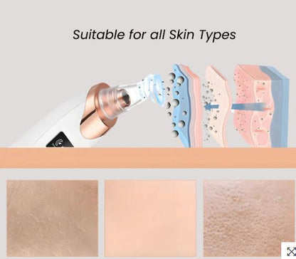 Acne remover household Pore Cleaner