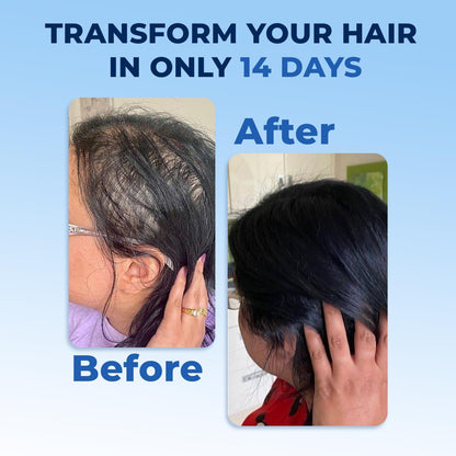 FEGPlus Minoxidil Beard & Hair Growth Serum