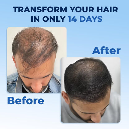 FEGPlus Minoxidil Beard & Hair Growth Serum