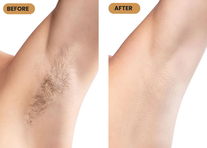 IPL Hair Remover
