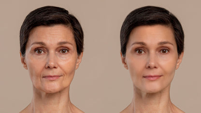 Anti Wrinkle Beauty Apparatus