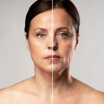 Anti Wrinkle Beauty Apparatus